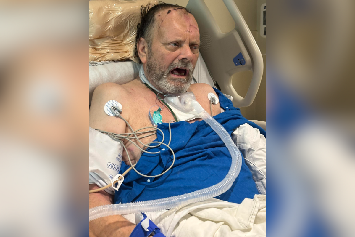 A man lying in a hospital bed with visible medical equipment and head injuries following a serious traffic accident.